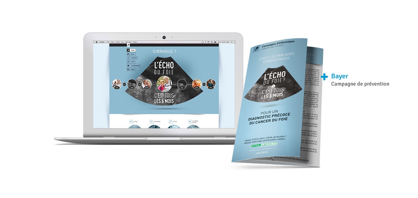 SLIDER-Bayer-oncologie-1367x650px